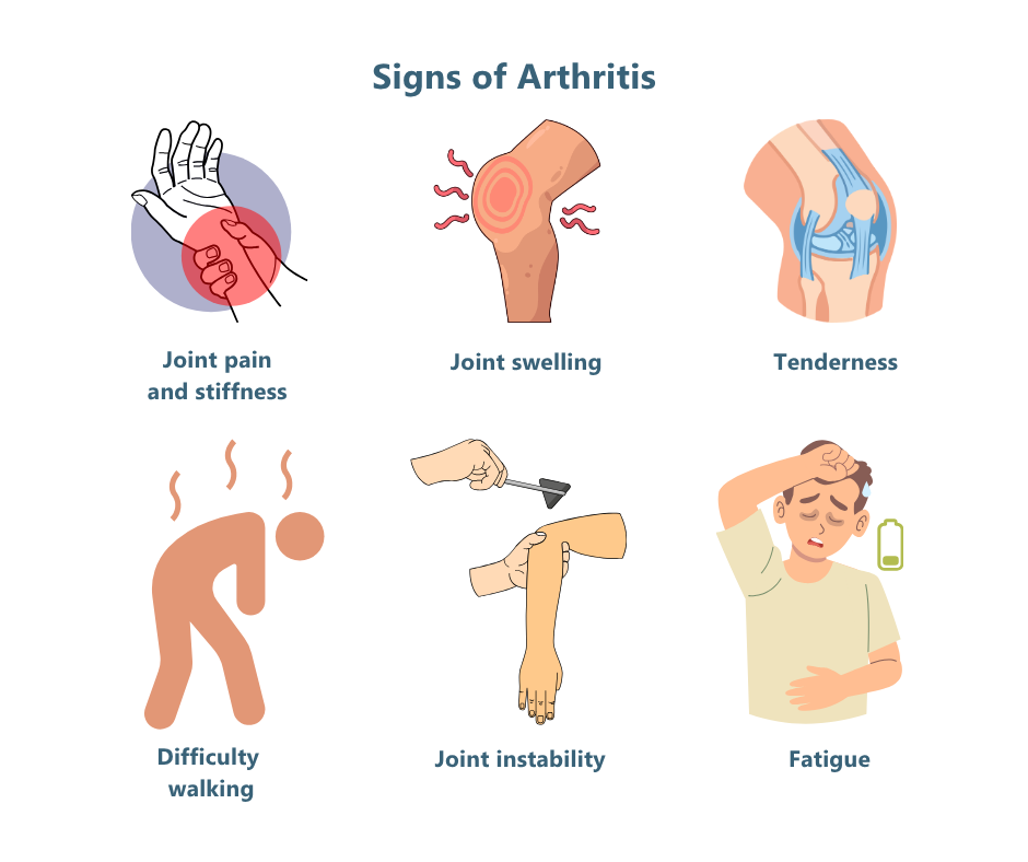 signs of arthritis